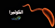 اليونيسف تؤكد تفشي وباء الكوليرا في اليمن