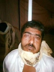 صورة القيادي الميداني في جبهة الاحكوم "ابو مالك الارحبي" الذي تم اسره في حيفان بتعز