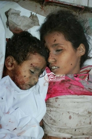 صورة الطفلتين التي قتلت بقصف المليشيات منزلا غربي تعز